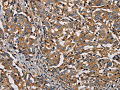 PLIN3 Antibody