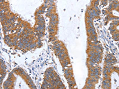 TNF Antibody