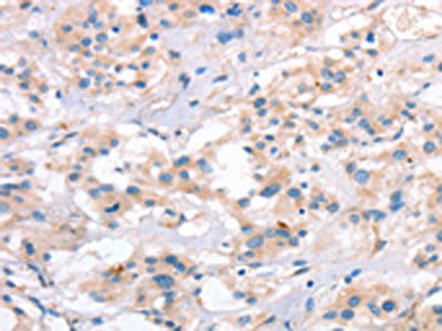 SLC4A1 Antibody