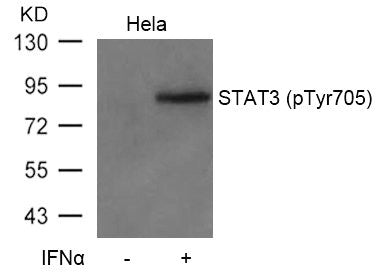 Phospho-STAT3 (Tyr705) Antibody