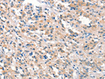 KCNB1 Antibody