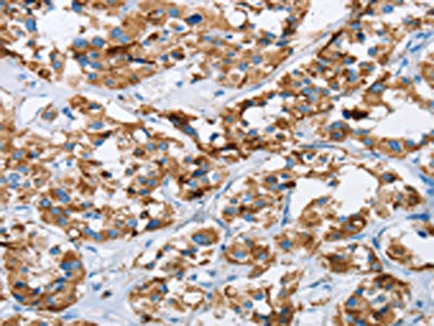 HINT2 Antibody