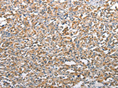 TSC2 Antibody