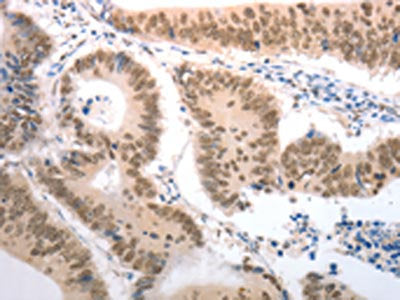 RAD52 Antibody