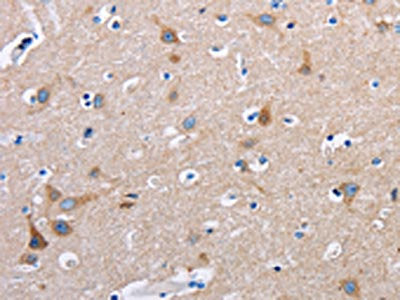 FN1 Antibody
