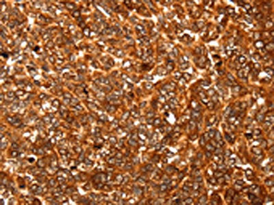ALDOA Antibody