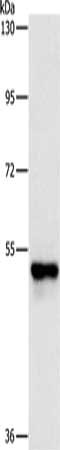 PFKFB2 Antibody