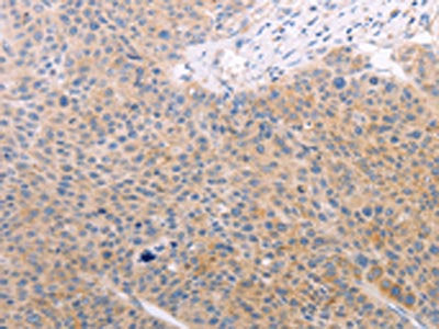 SPATA16 Antibody