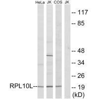 RPL10L Antibody