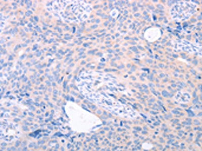 TRIM32 Antibody