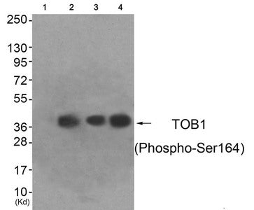 Phospho-TOB1 (Ser164) Antibody