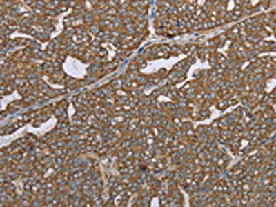 CERS4 Antibody