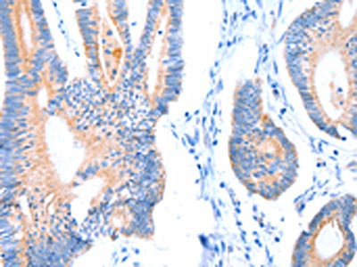 ACADS Antibody
