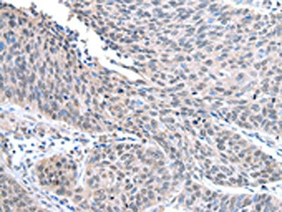 STRAP Antibody