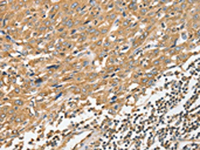 ANGPTL7 Antibody