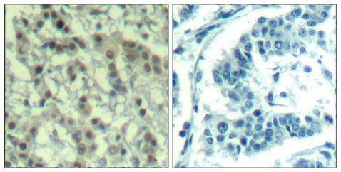 Phospho-AURKA (Thr288) Antibody
