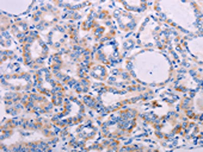 AGT Antibody