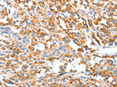 CLIP1 Antibody