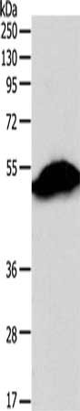 SIRT6 Antibody