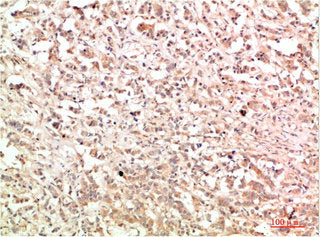 ABL1 Antibody