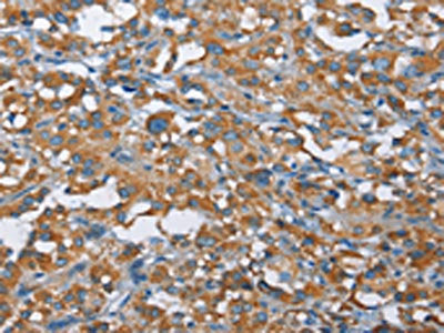 KLF7 Antibody