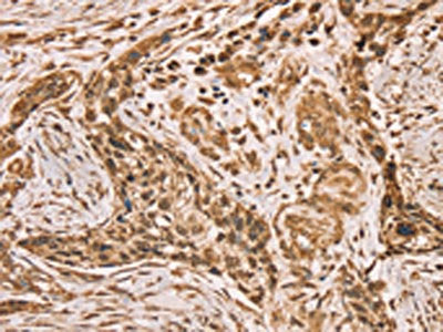 HIF1AN Antibody