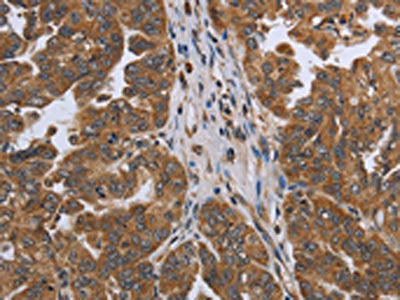 NDUFAF4 Antibody