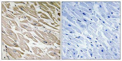 Phospho-PPP1R2 (Ser120/Ser121) Antibody