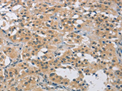FOSB Antibody