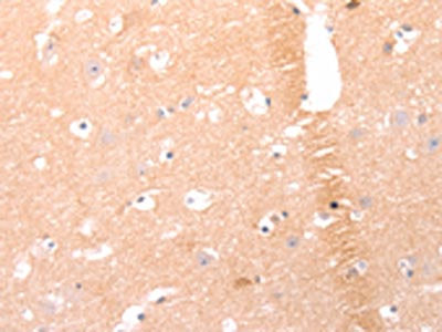 AMH Antibody