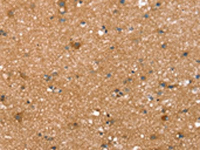 SPATA5L1 Antibody