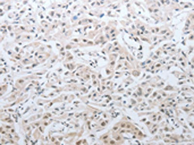 DNAJC7 Antibody