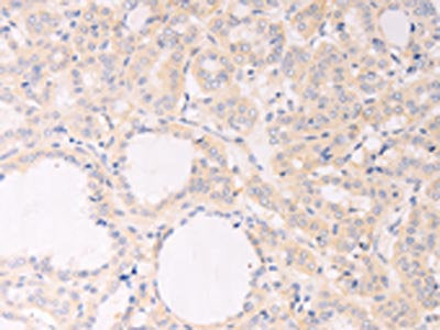 F7 Antibody