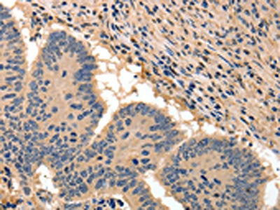 BAIAP2 Antibody