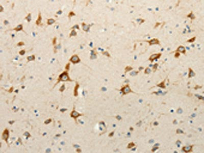 RPAP3 Antibody