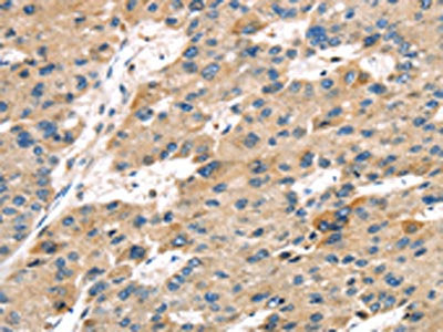 SERPINB8 Antibody