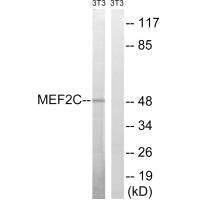 MEF2C (Ab-396) Antibody