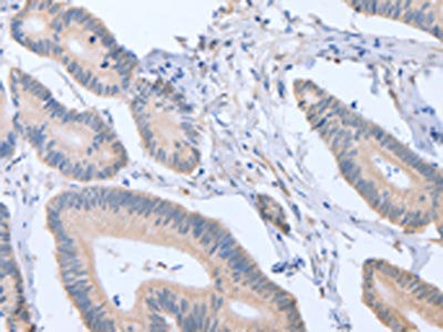 ACVR1C Antibody