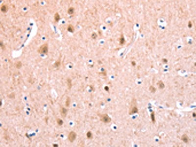 BMPR2 Antibody
