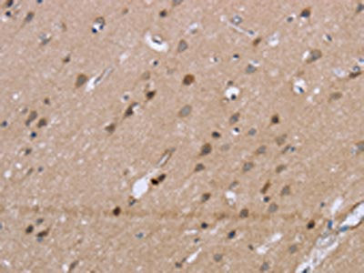 GSN Antibody