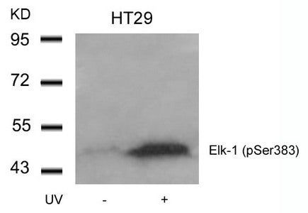 Phospho-ELK1 (Ser383) Antibody