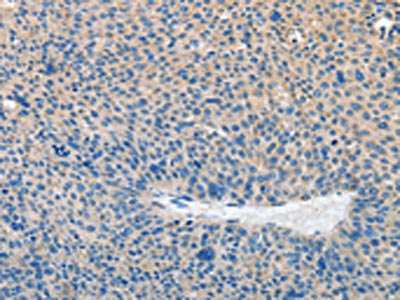 PRKG2 Antibody