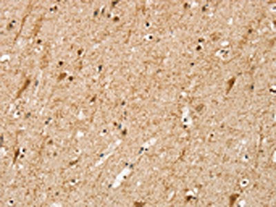 SRP68 Antibody