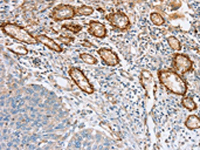 SEMA7A Antibody