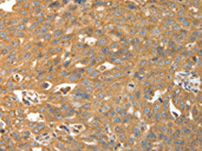 CALR Antibody