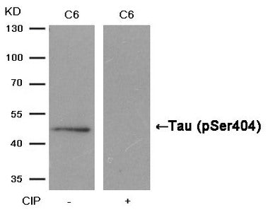 Phospho-MAPT (Ser404) Antibody