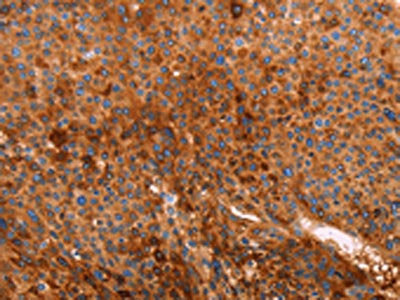 GC Antibody