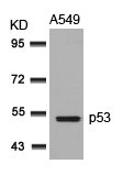 TP53 (Ab-315) Antibody