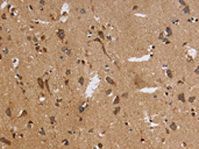 ITPR3 Antibody