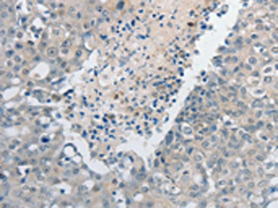 GCH1 Antibody